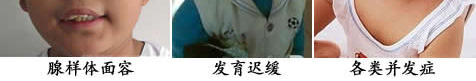 腺样体危害